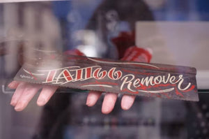 Laser Tattoo Removal:  How to Care for Your Skin During and After