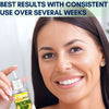 Piercing Bump Treatment Keloid Bump Removal - Nose Piercing Cleaner Ear Piercing Cleaning Solution - Bump Shrinking Drops Keloid Bump Removal - Aftercare Piercing Solution
